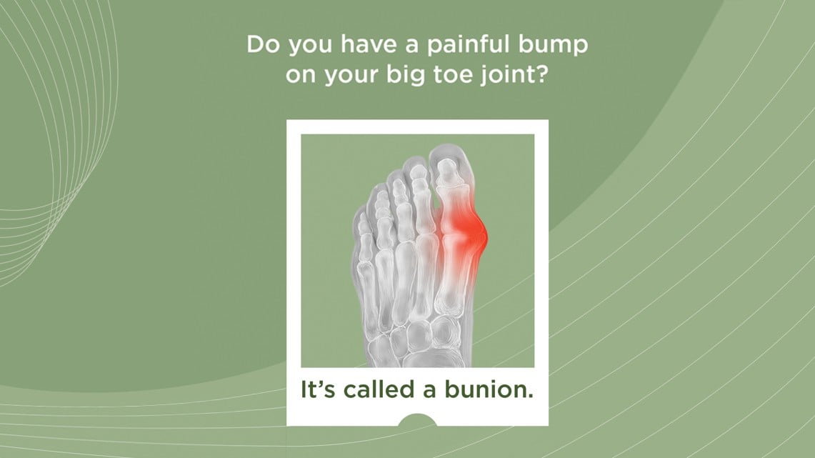 Finding the Perfect Shoes for Bunions – A Guide for Men & Women | Biofoot